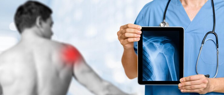 Arthroscopic Shoulder Surgery