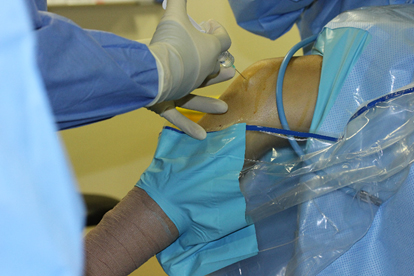 Cartilage Injury Treatment