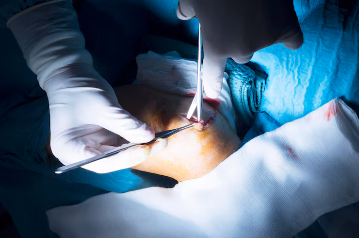 Minimally Invasive Fracture Care