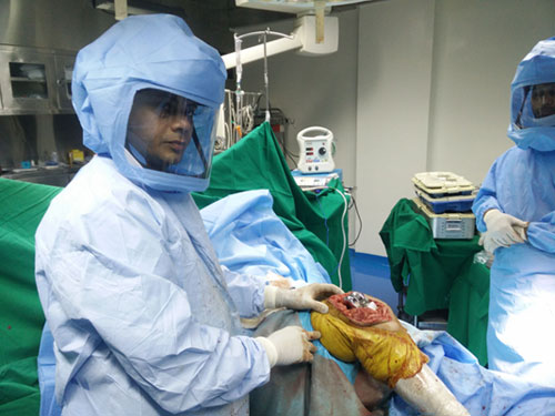 Revision Joint Replacement